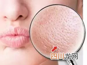 毛孔粗大怎么修复?