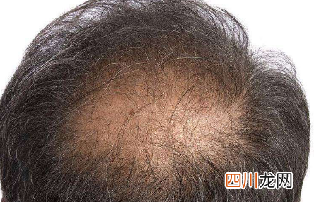 广东南方医学研究院密丝培源是真的假的