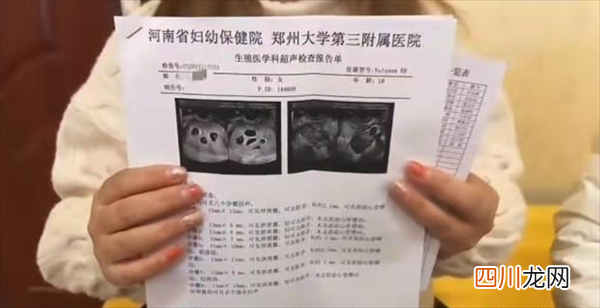 郑州怀八胞胎女子仅18岁！确实曾打促排卵针