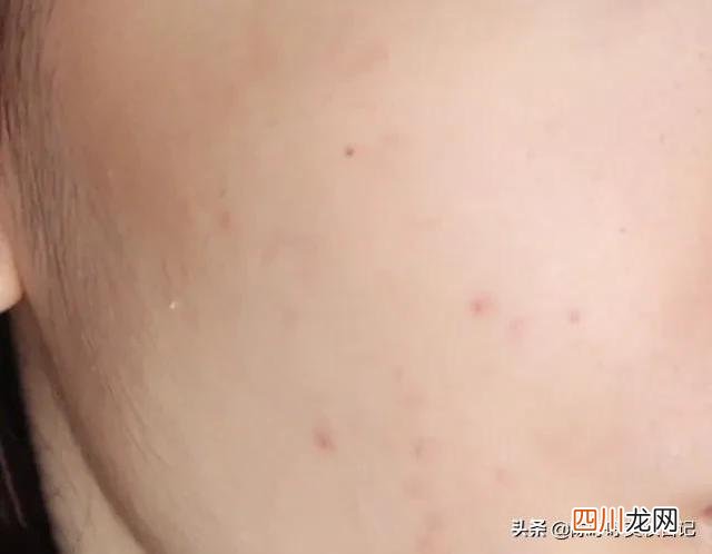 抗衰老的方法都在这 如何抗衰老？方法不对，护肤品全废，花三分钟get抗老超级干货