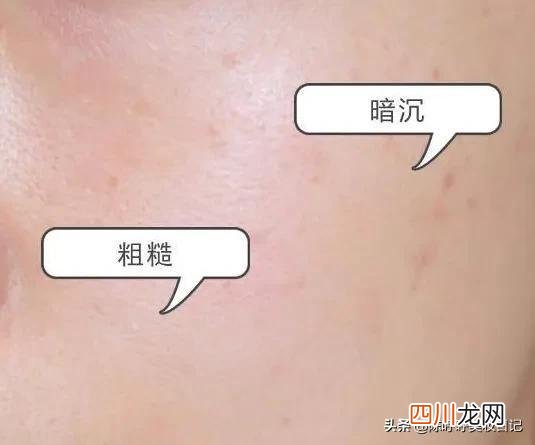 抗衰老的方法都在这 如何抗衰老？方法不对，护肤品全废，花三分钟get抗老超级干货