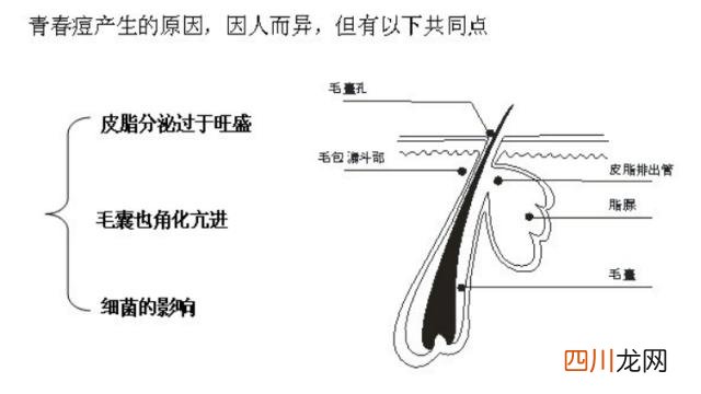 额头长痘痘是什么原因？眉心长痘痘是什么原因？长痘痘位置图解