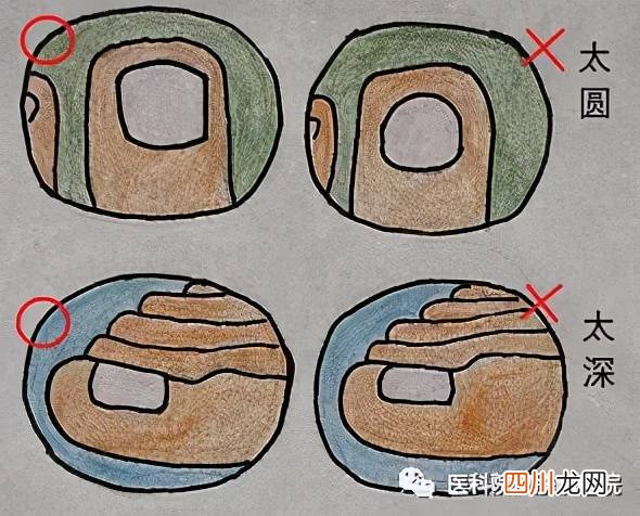 右脚大拇指指甲疼痛是什么原因 右脚大拇指疼预示什么