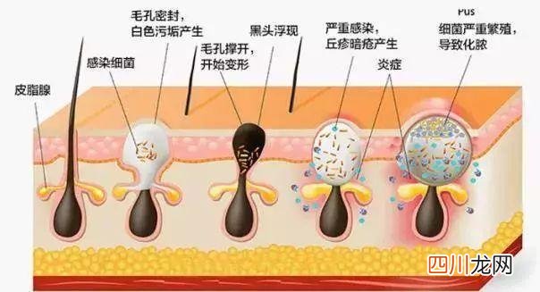 硅胶洁面仪有用吗？我们一起来扒一扒