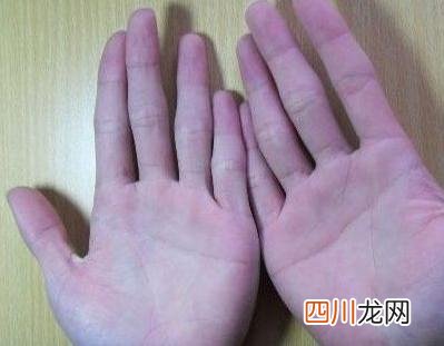 男人双手断掌意义是什么 断掌好不好