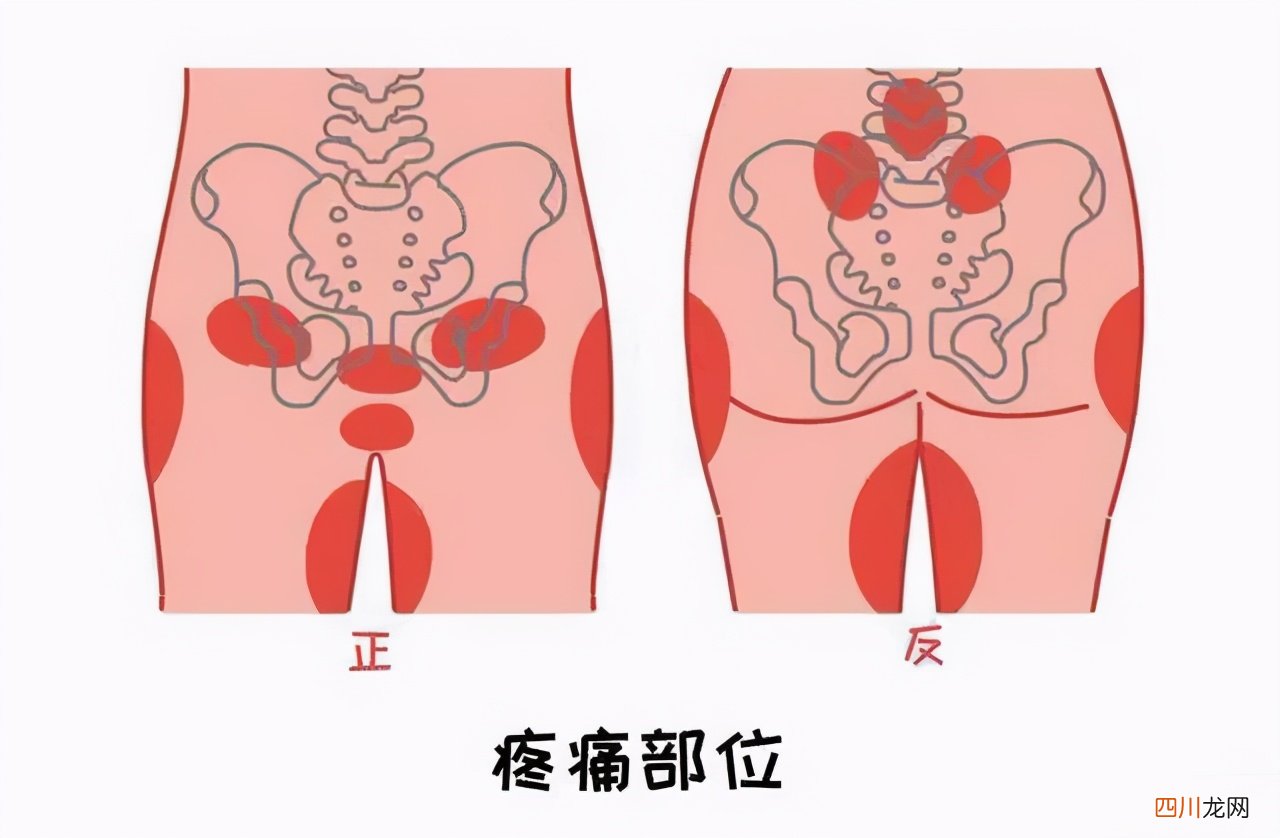 孕妇耻骨准确位置图片 孕妇耻骨图片表面