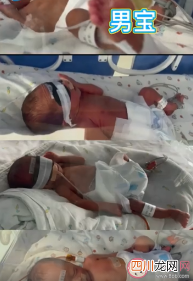 新乡一产妇第三胎生下龙凤四胞胎 怀了多胞胎要注意些什么