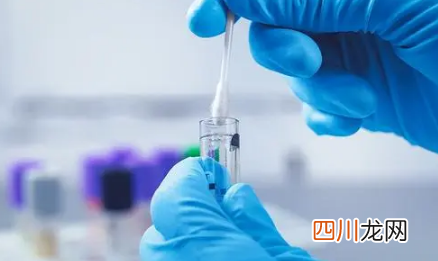 2022年春季开学要做核酸检测吗