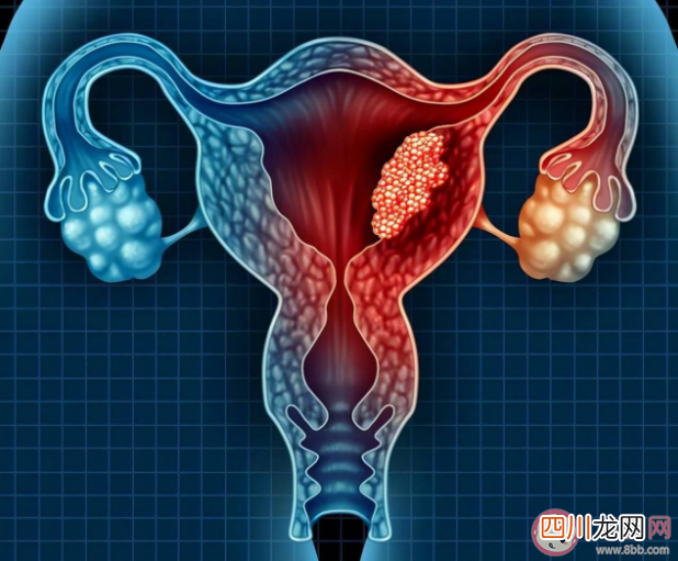 宫颈糜烂和男性有关系吗 宫颈糜烂和宫颈炎有什么不同