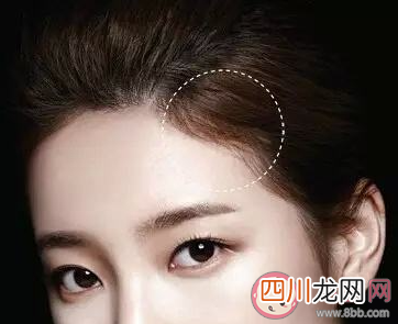 经常扎头发发际线会变高吗 为什么发际线会变高