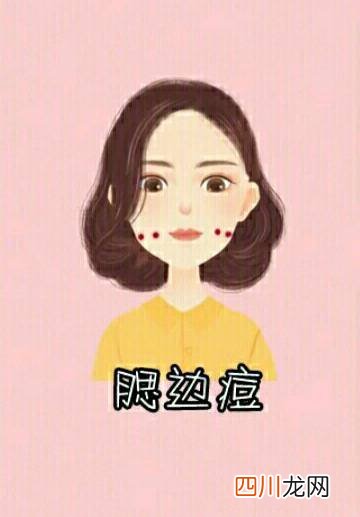 为什么右边脸老是长痘 右脸长痘痘是什么原因