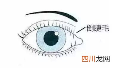 小孩散光能治好吗 什么是散光近视