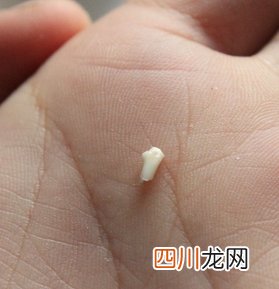 晚上梦见自己掉牙了，是怎么回事？ 做梦梦见牙掉了