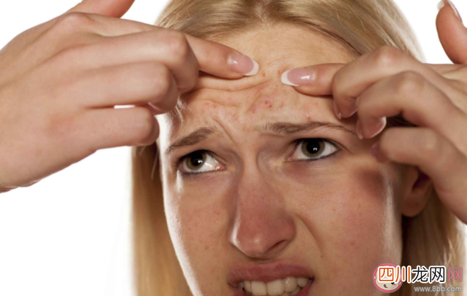 人为什么会长痘痘 长了痘痘一定要注意的8件事