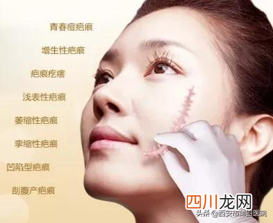 激光后多久掉痂 激光后多久结痂