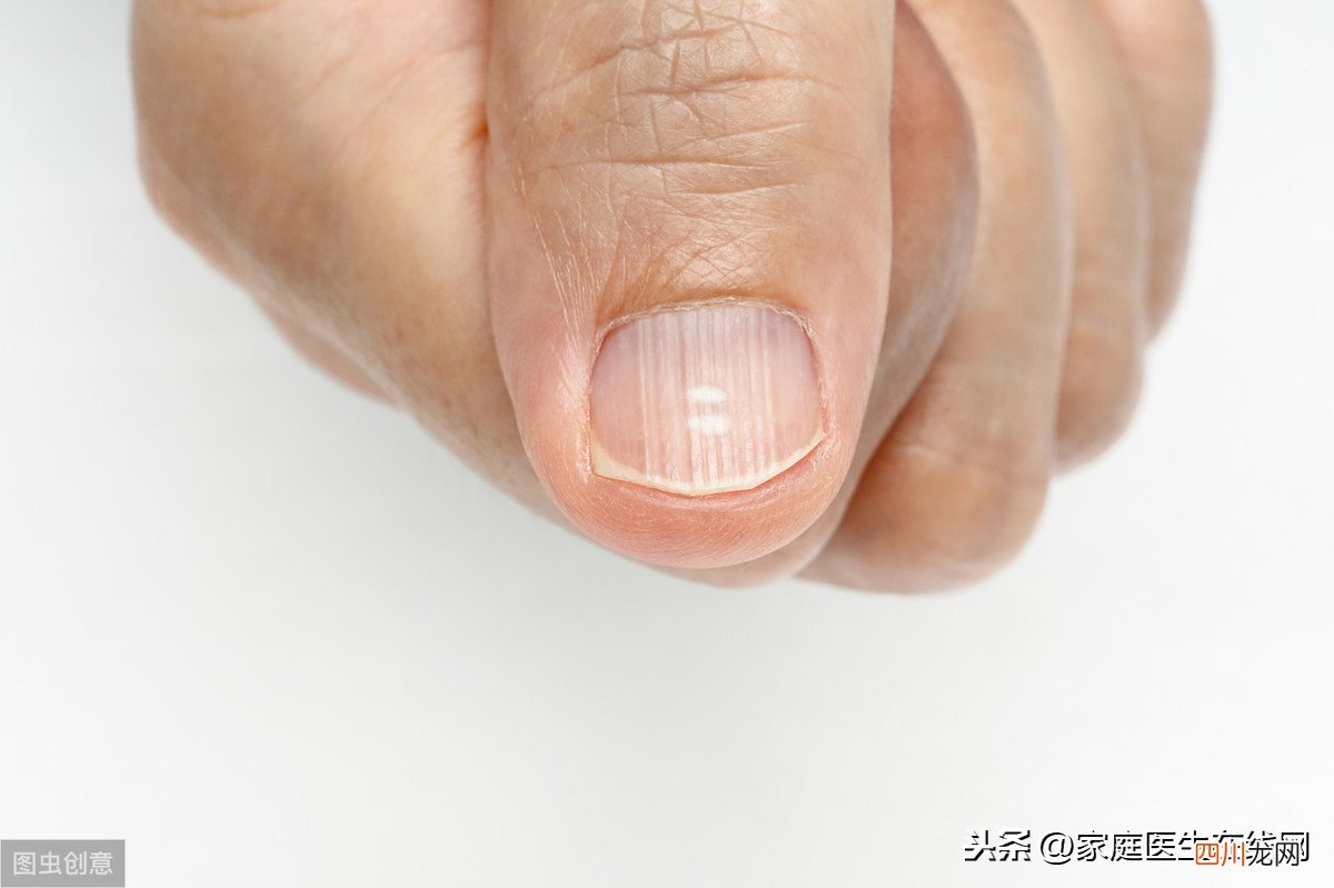 指甲有竖纹是身体的什么信号？指甲有竖纹是怎么回事？