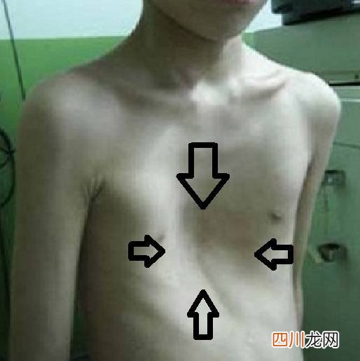 开胸手术后多久能侧睡 后多久可以侧睡