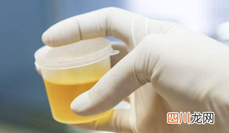 不喝水就基本没尿是肾炎吗