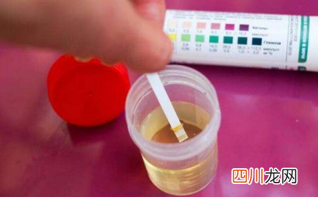不喝水就基本没尿是肾炎吗