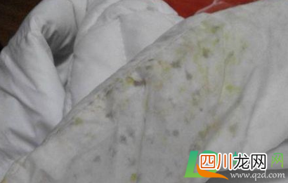 黑色羽绒服起霉点怎么洗掉