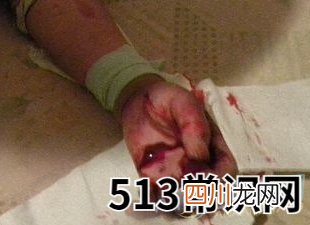 梦见自己打架流血代表着什么？注重梦境变化