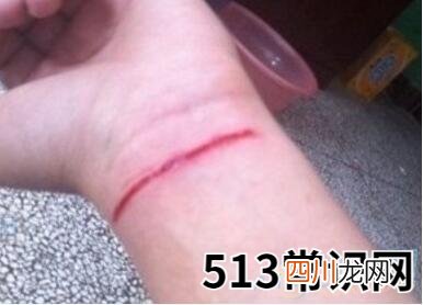 梦见手腕流血象征含义解读:与财运有关