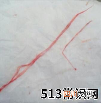 梦见血管里有虫子有着怎样的含义？