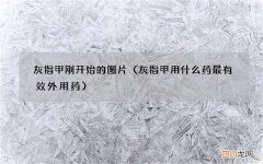 灰指甲用什么药最有效外用药 灰指甲刚开始的图片