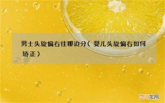 婴儿头旋偏右如何矫正 男士头旋偏右往哪边分