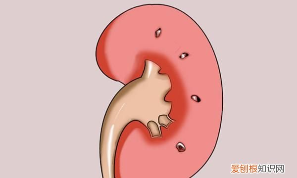 得肿瘤身体会有肿块吗，体内的一切肿块都属于肿瘤吗