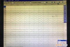 30min是什么意思，光照时间30min是什么意思