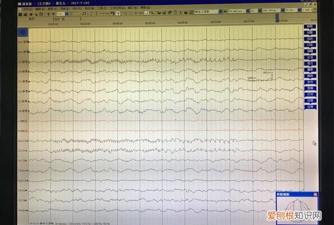 30min是什么意思，光照时间30min是什么意思