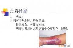 疽怎么读，寻常疣怎么读的请帮忙回？