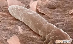 床单上的灰尘是螨虫，床单上黄颗粒是螨虫么