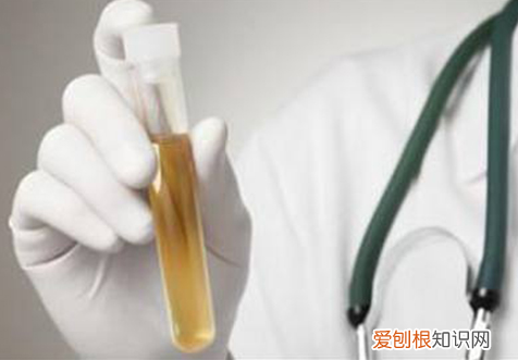 小便发黄是怎么回事？ 尿黄的原因
