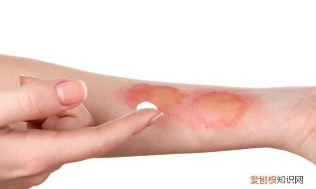 家里没牙膏了怎么应急刷牙