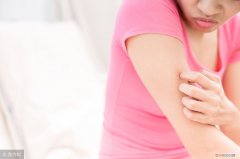 治疗扁平苔藓，要从这6方面下手 扁平苔藓治疗