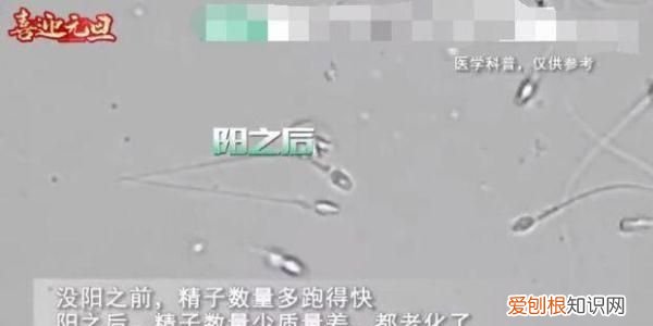 夫妻阳康后着急备孕医生劝阻,阳康之后多久可以备孕