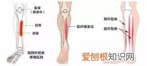 小腿骨膜炎的主要症状有哪些？ 小腿骨膜炎的症状
