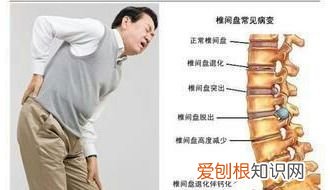 腰椎间盘突出症的治疗方法全集 治疗腰椎间盘突出的好方法