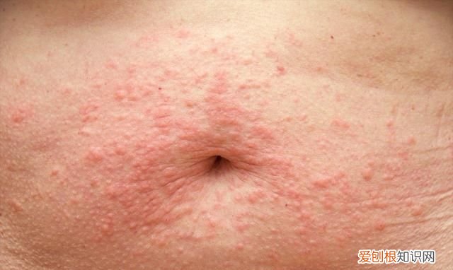 衣柜里的樟脑丸气味对人身体有害吗