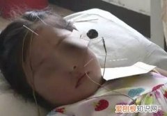 空调电扇整晚吹，一觉醒来成了面瘫！ 电扇吹脸一夜面瘫