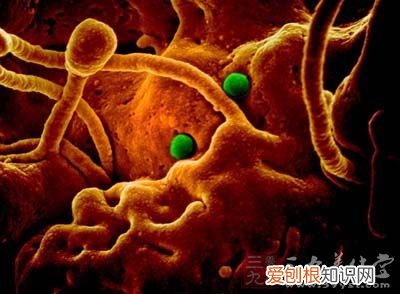 3分钟剖析中东呼吸综合症 中东呼吸综合症