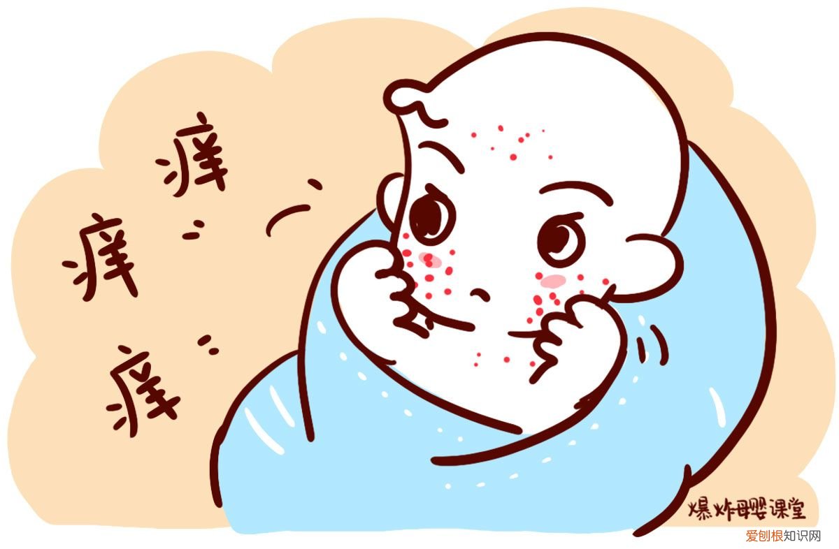 孩子得了水痘怎么办? 小孩起水痘怎么办