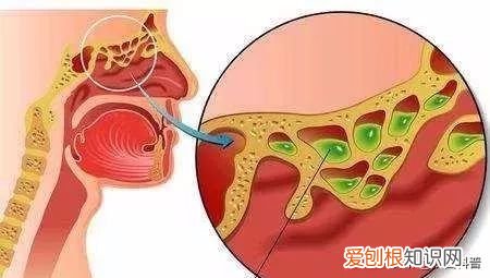 冬天这么干加湿器到底有用吗？ 加湿器有用吗