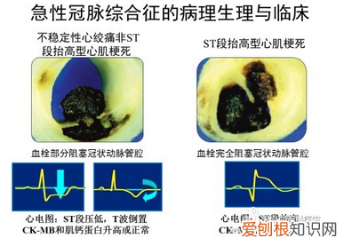 心血管系统详解知识点 心血管系统