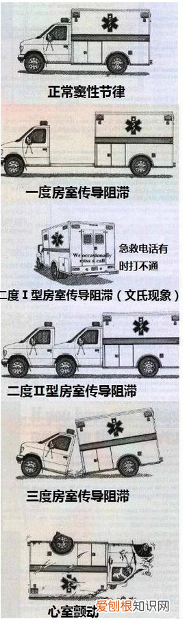 心血管系统详解知识点 心血管系统