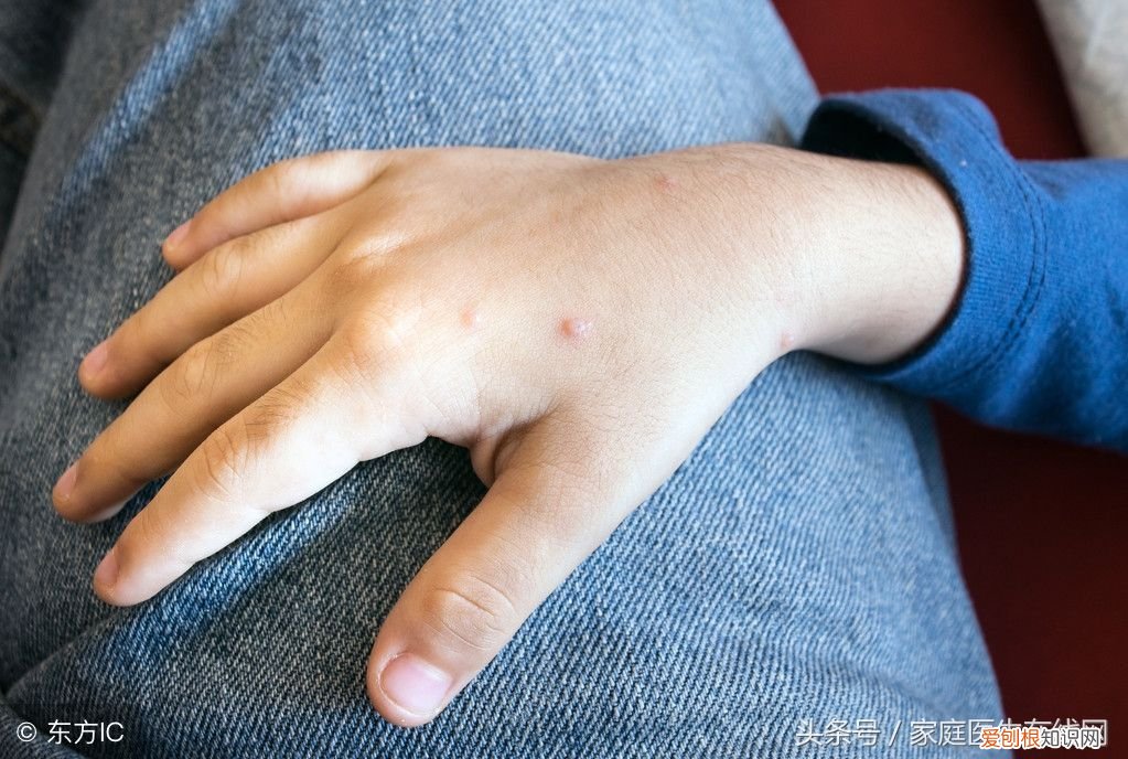 手上长的小水泡到底是什么东西 手上起小水泡