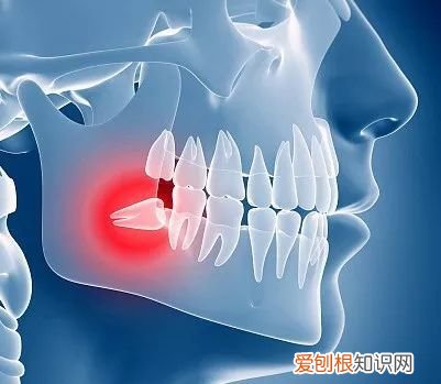 成年后都会长智齿吗 智齿什么时候长