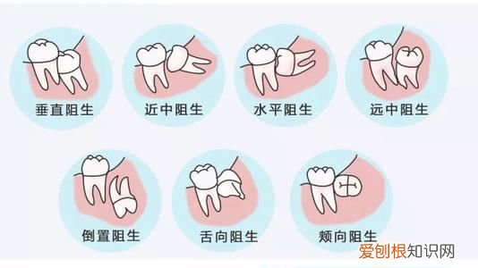 成年后都会长智齿吗 智齿什么时候长